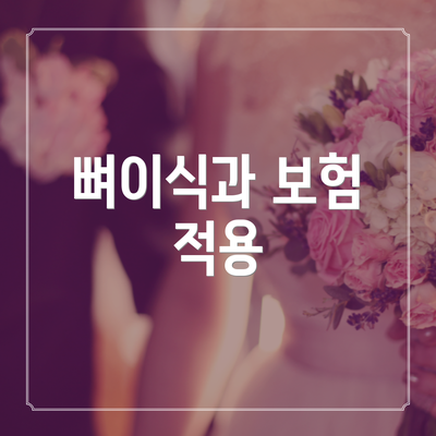 뼈이식과 보험 적용